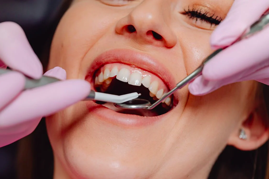 Denti: Cosa Sono i Denti? Differenze fra dente e dente