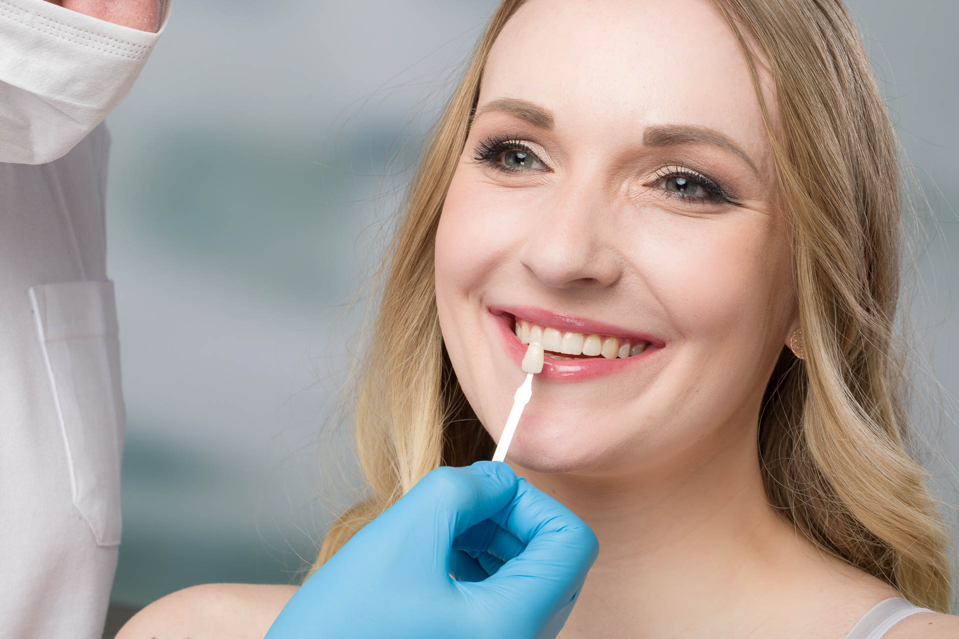 faccette dentali