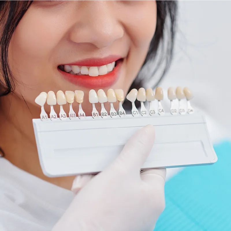 Che cosa sono le faccette per i denti?